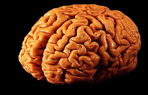 Cerebro humano. Fotografía de Allan Ajifo con licencia Creative Commons