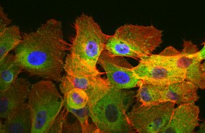 Células de epitelio de mama moviéndose hacia la parte más rígida de una superficie. La actina se muestra en rojo, la paxilina verde y los núcleos en azul.