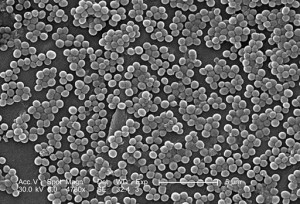 Microscopio electrónico de barrido mostrando al Staphylococcus aureus resistente a meticilina